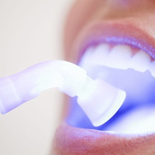 clareamento dental banner-min