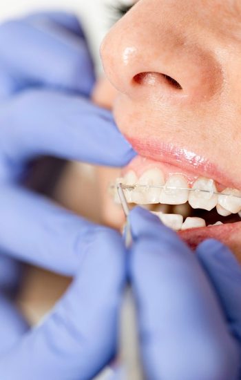 ortodontia tratamento-min